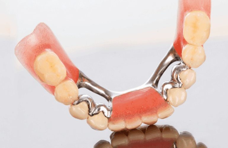 Dentures